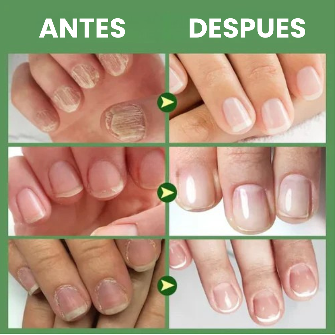 Endurecedor y Reparador de Uñas BioActiva®